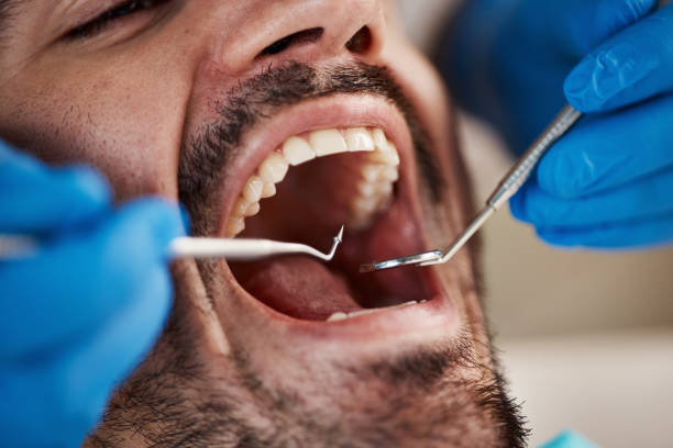 Best Emergency Dental Filling Replacement  in Golden Meadow, LA